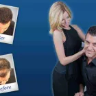 Entreprises 1 image SURE HAIR INTERNATIONAL Hair Loss Treatments & Clinics dans Toronto ON