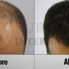 Entreprises 4 image SURE HAIR INTERNATIONAL Hair Loss Treatments & Clinics dans Toronto ON