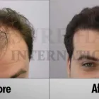 Entreprises 9 image SURE HAIR INTERNATIONAL Hair Loss Treatments & Clinics dans Toronto ON