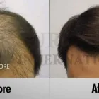 Entreprises 10 image SURE HAIR INTERNATIONAL Hair Loss Treatments & Clinics dans Toronto ON
