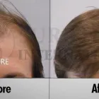 Entreprises 12 image SURE HAIR INTERNATIONAL Hair Loss Treatments & Clinics dans Toronto ON