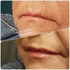 Entreprises 4 image THE ALCHEMY ROOM Skin Care Clinics & Services dans Edmonton AB
