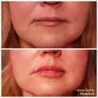 Entreprises 2 image THE ALCHEMY ROOM Skin Care Clinics & Services dans Edmonton AB