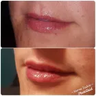 Entreprises 8 image THE ALCHEMY ROOM Skin Care Clinics & Services dans Edmonton AB