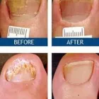 Entreprises 2 image TOENAIL FUNGUS TREATMENT-- LASER NAIL THERAPY CLINIC Laser Surgery dans Montréal QC