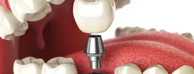 Entreprises 12 image KEELE CROSSTOWN DENTAL Dentures dans York ON