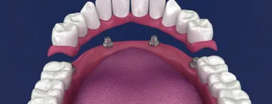 Entreprises 13 image KEELE CROSSTOWN DENTAL Dentures dans York ON