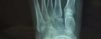 Business 8 image L'INSTITUT PODIATRIQUE DU QUÉBEC Health & Medicine in Saint-Laurent QC