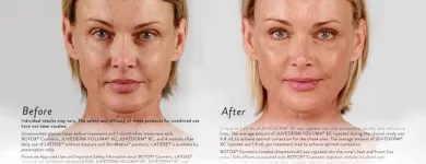 Business 3 image LAKESHORE VEIN & AESTHETICS CLINIC INC Health & Medicine in Kelowna BC