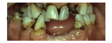 Business 3 image LONDONDERRY DENTURE CLINIC Health & Medicine in Edmonton AB