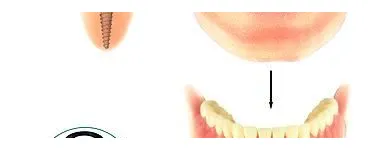 Entreprises 6 image MARCOUX DENTUROLOGISTE Health & Medicine dans Dieppe NB