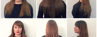 Entreprises 12 image PACIFIC HAIR LOSS SOLUTIONS Wigs & Hairpieces dans Vancouver BC