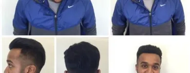 Entreprises 16 image PACIFIC HAIR LOSS SOLUTIONS Wigs & Hairpieces dans Vancouver BC