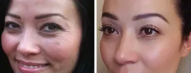 Business 5 image SACHEEN'S SKINCARE SOLUTIONS Skin Care Clinics & Services in Kelowna BC
