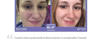 Business 6 image SACHEEN'S SKINCARE SOLUTIONS Skin Care Clinics & Services in Kelowna BC