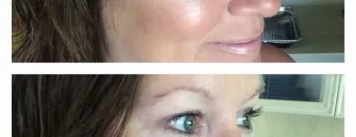 Business 2 image SACHEEN'S SKINCARE SOLUTIONS Skin Care Clinics & Services in Kelowna BC