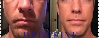 Business 10 image SACHEEN'S SKINCARE SOLUTIONS Skin Care Clinics & Services in Kelowna BC