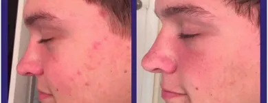 Business 11 image SACHEEN'S SKINCARE SOLUTIONS Skin Care Clinics & Services in Kelowna BC