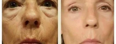 Business 12 image SACHEEN'S SKINCARE SOLUTIONS Skin Care Clinics & Services in Kelowna BC