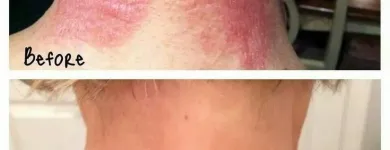 Business 1 image SACHEEN'S SKINCARE SOLUTIONS Skin Care Clinics & Services in Kelowna BC