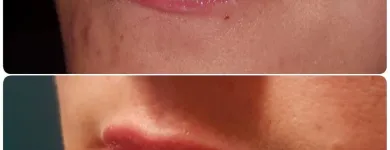 Entreprises 8 image THE ALCHEMY ROOM Skin Care Clinics & Services dans Edmonton AB