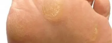 Business 5 image THE FOOT NURSE Nail Salons & Technicians in Kelowna BC