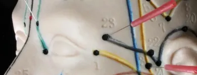 Entreprises 2 image THE PACIFIC WELLNESS INSTITUTE Shiatsu Therapists dans Toronto ON