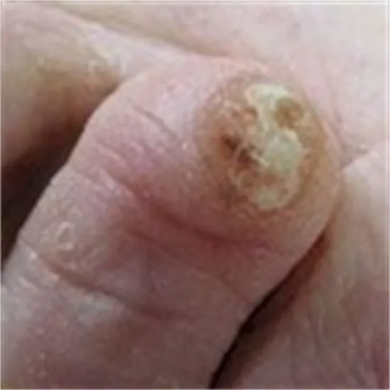 Business 1 image THE FOOT NURSE